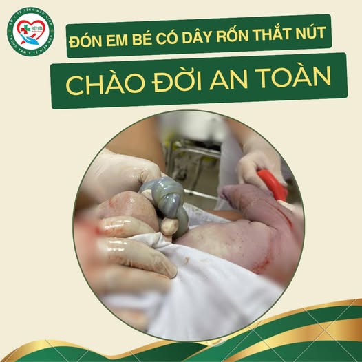 ĐÓN EM BÉ CÓ DÂY RỐN THẮT NÚT CHÀO ĐỜI AN TOÀN